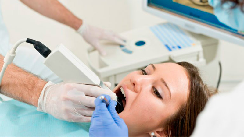 Incrustaciones estéticas en Piura